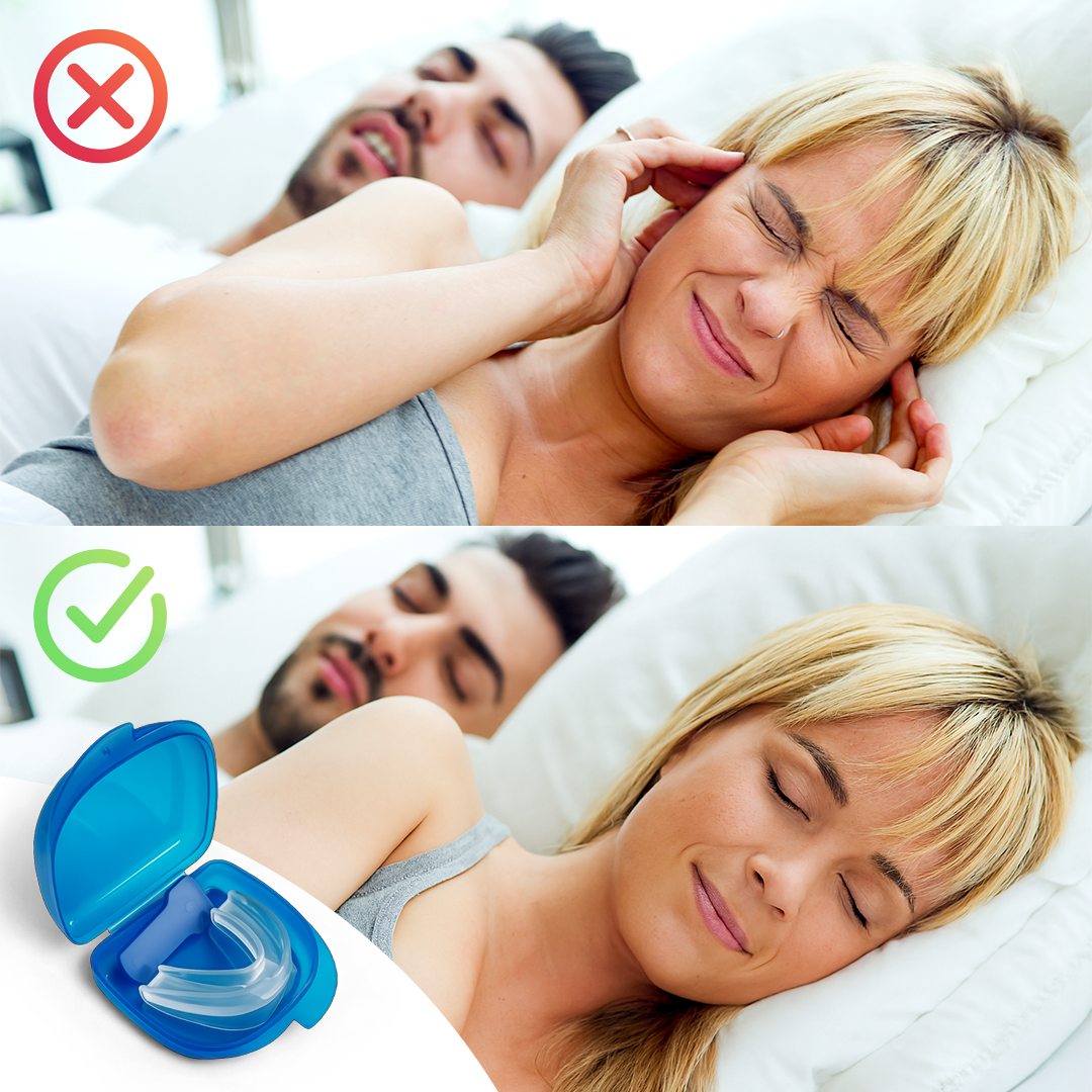 SnoozerShield The Silent Anti-Snoring Mouth Guard | Universal Fit